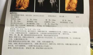 四维彩超报告单 四维彩超报告单